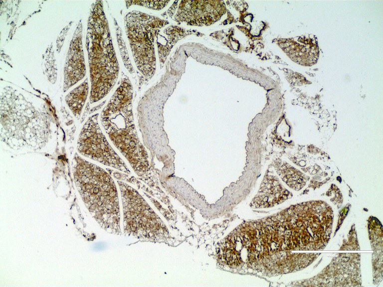 Histological section of a mouse aorta showing UCP1-stained adipose tissue in brown